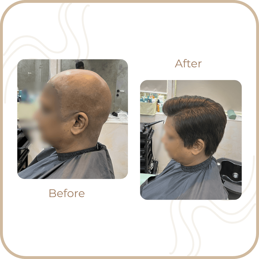 Hair Transformation
