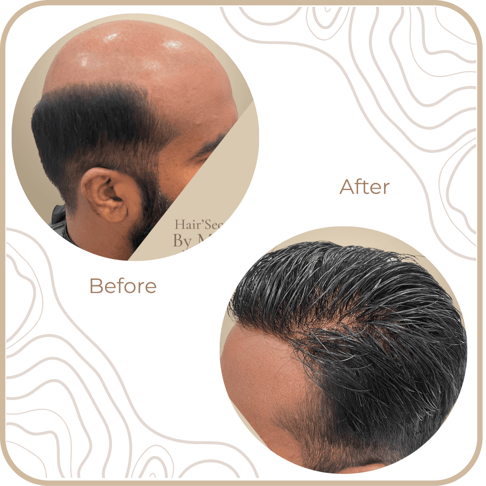 Hair Transformation
