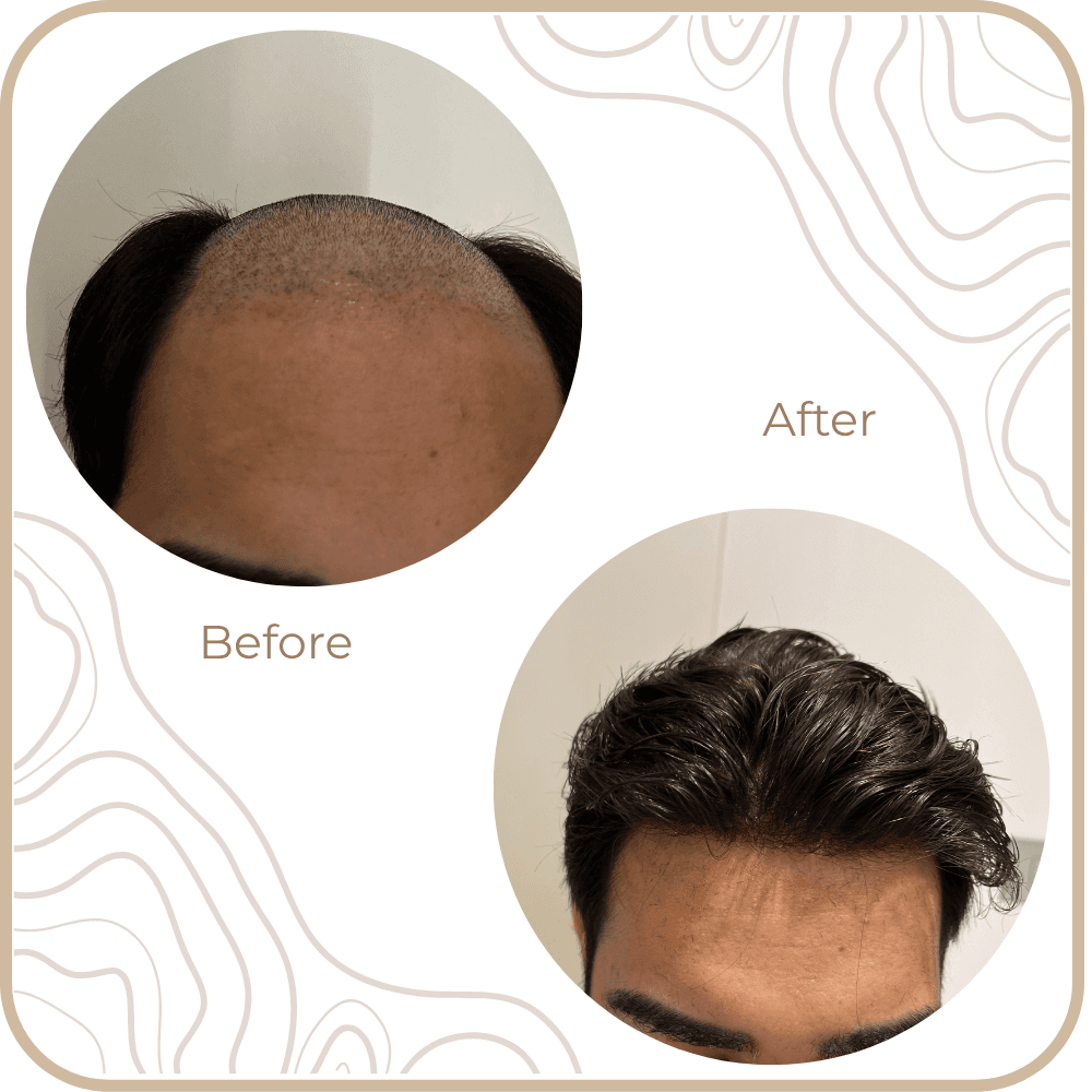 Hair Transformation