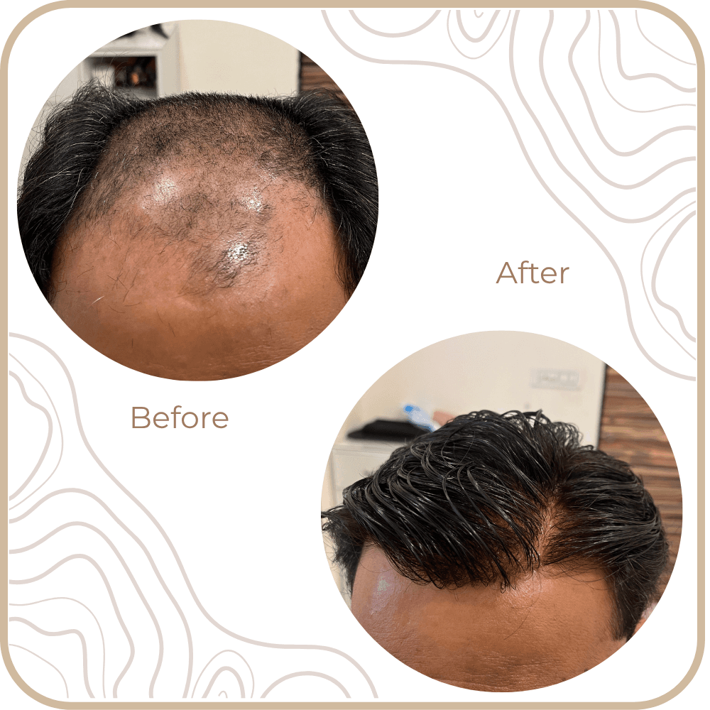 Hair Transformation