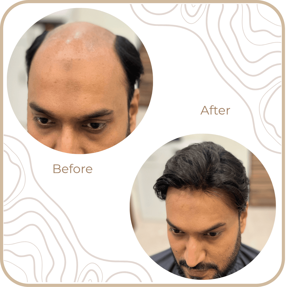 Hair Transformation