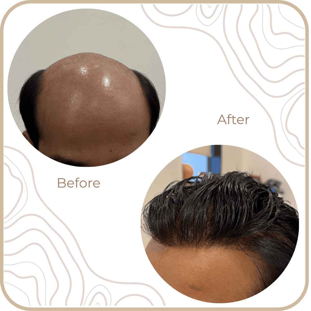 Hair Transformation