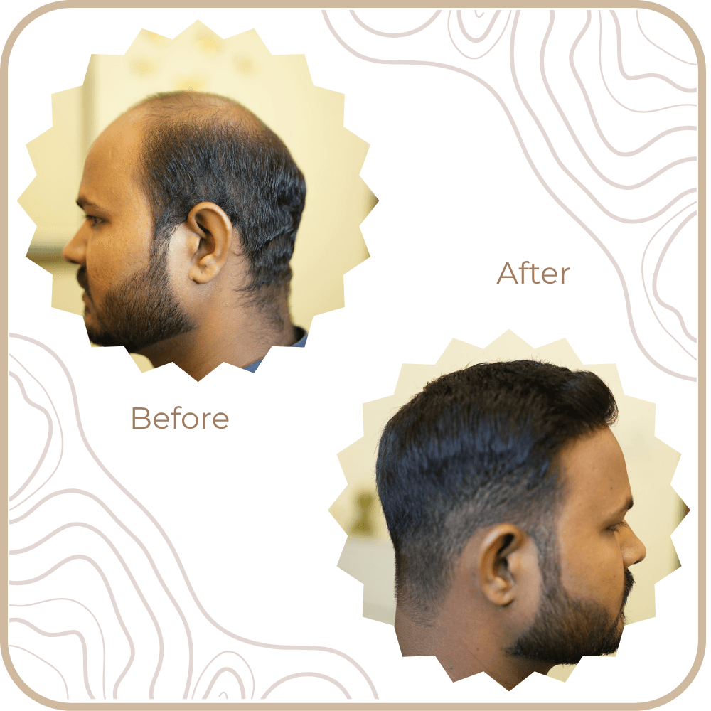 Hair Transformation