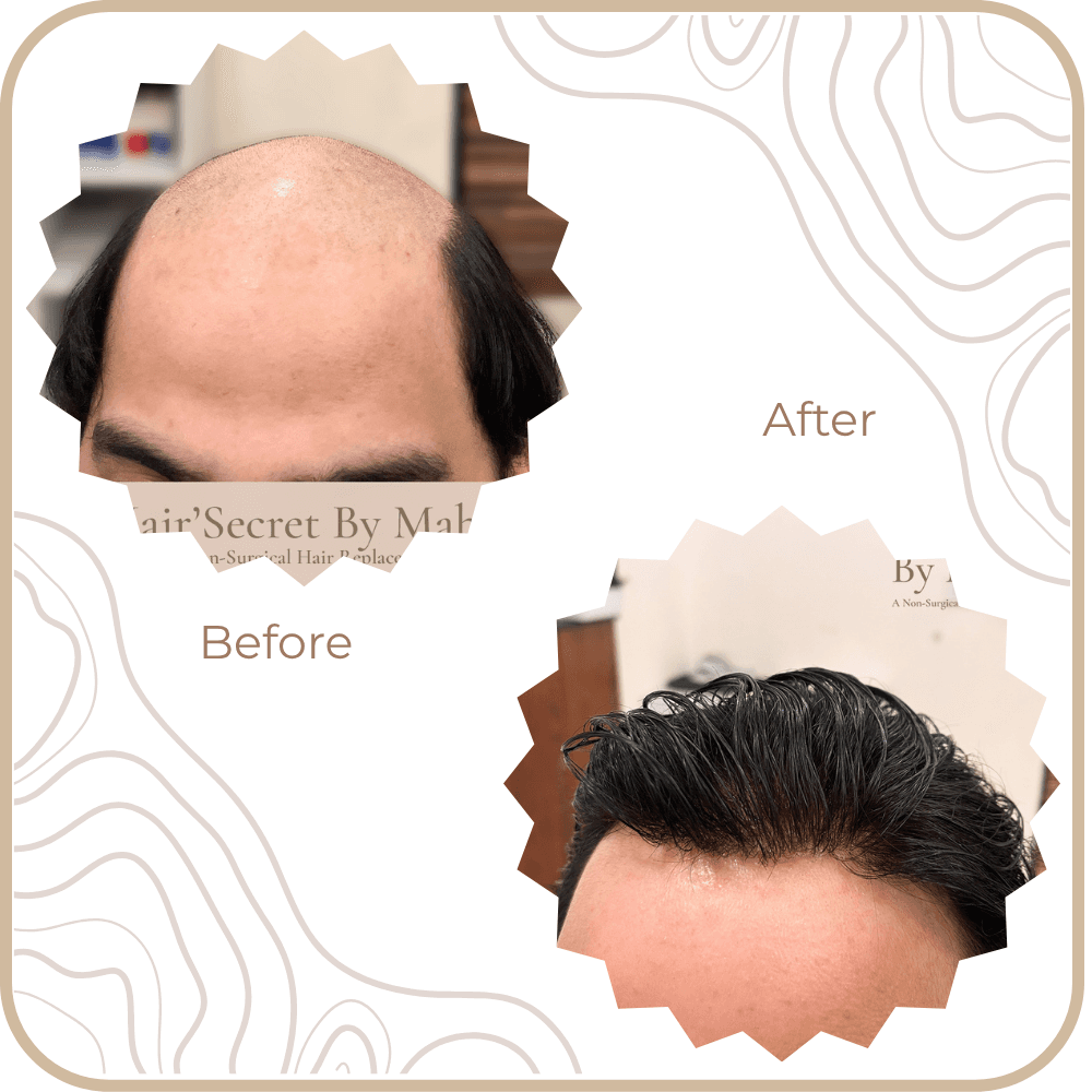 Hair Transformation