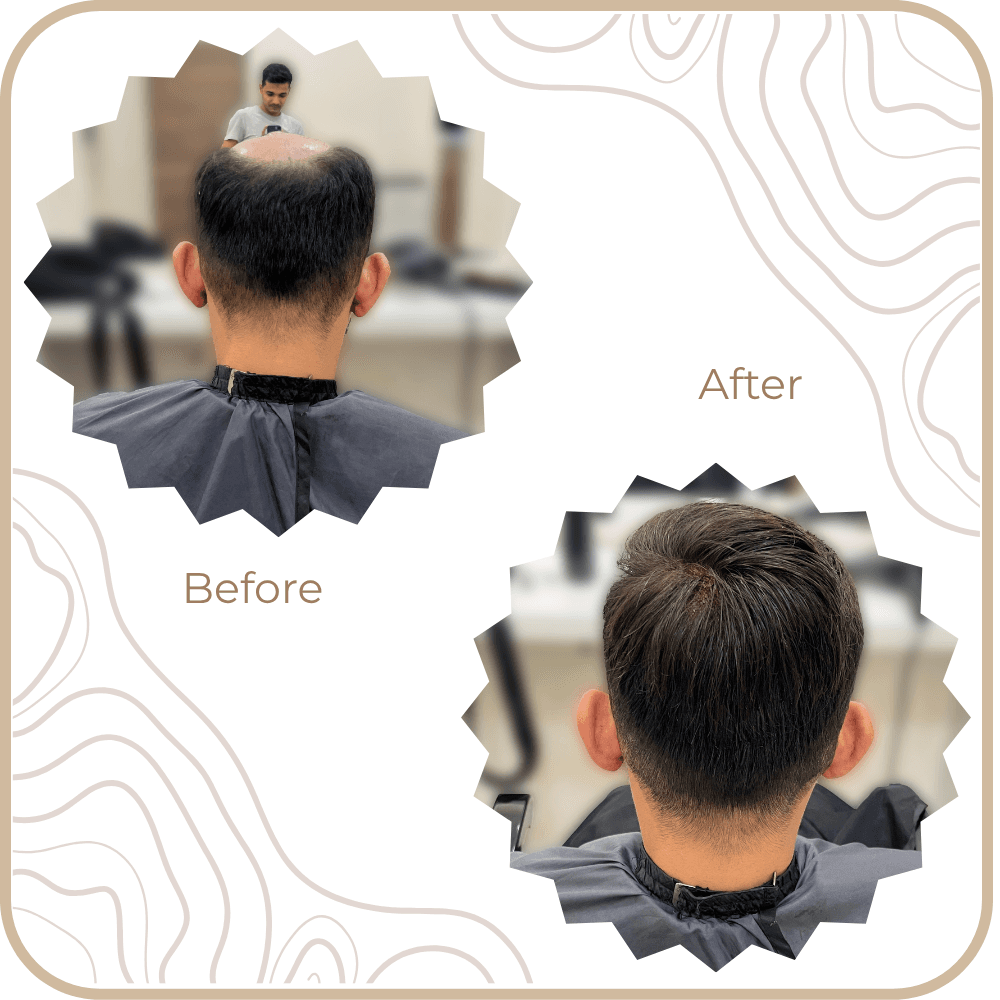 Hair Transformation