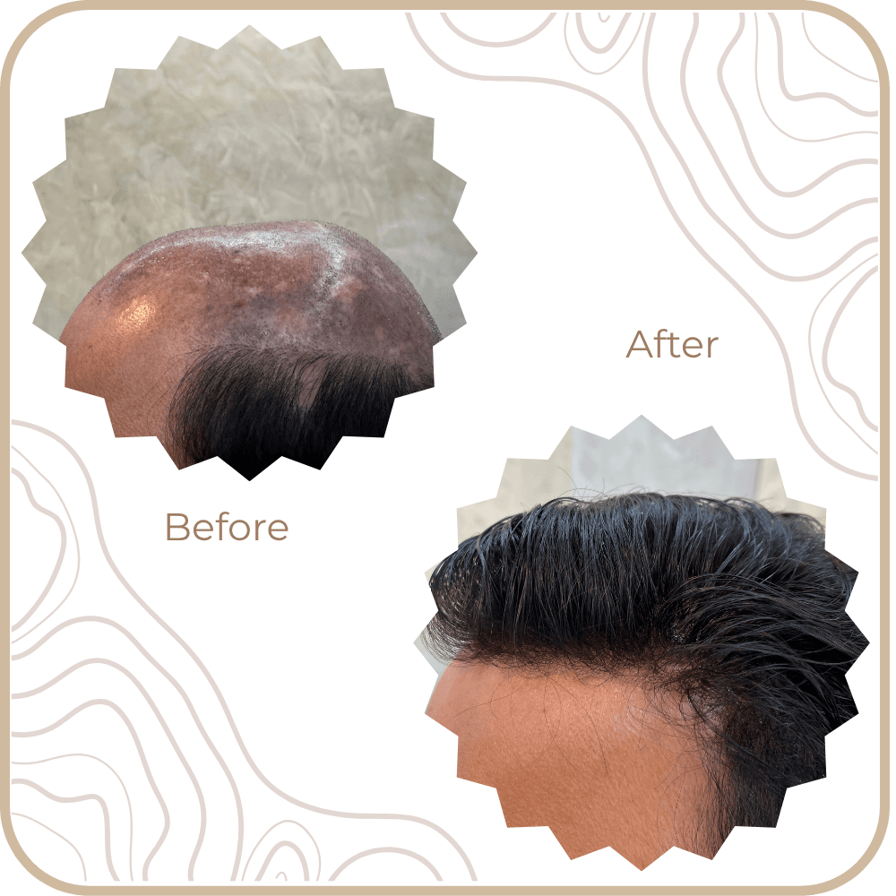 Hair Transformation