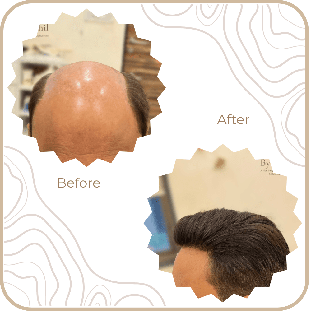 Hair Transformation