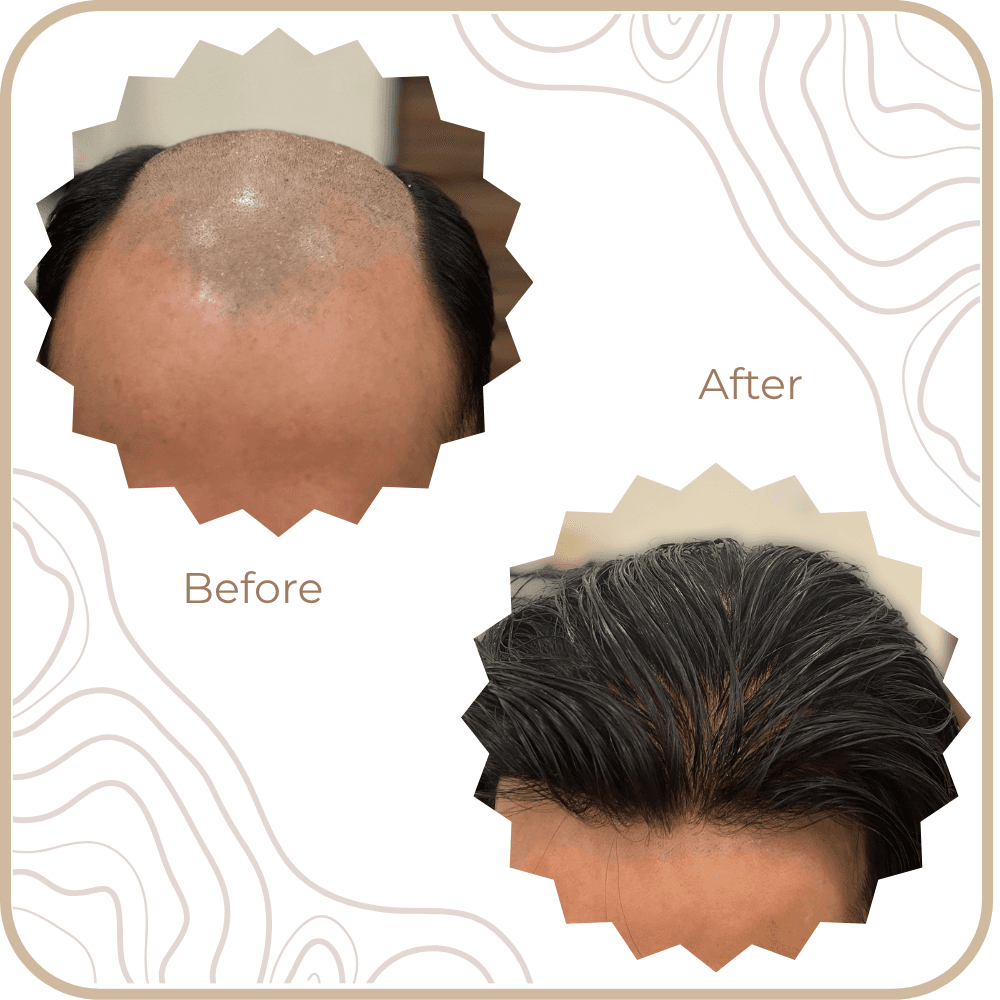 Hair Transformation