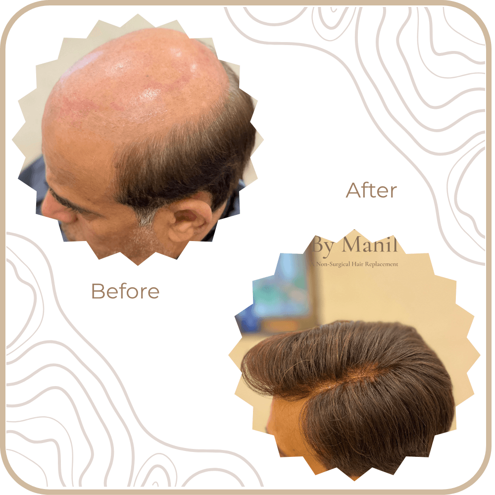 Hair Transformation