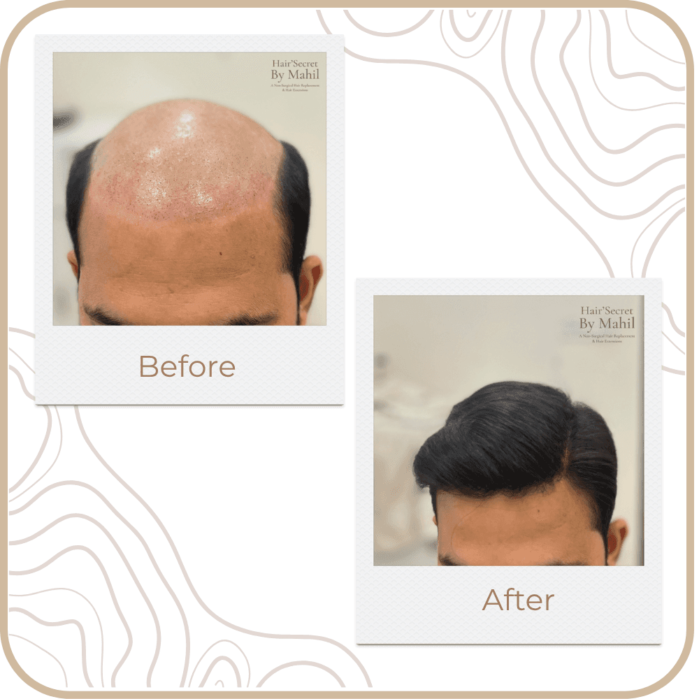 Hair Transformation