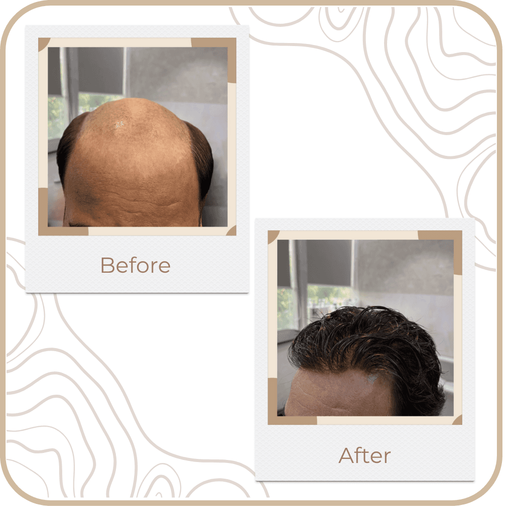 Hair Transformation
