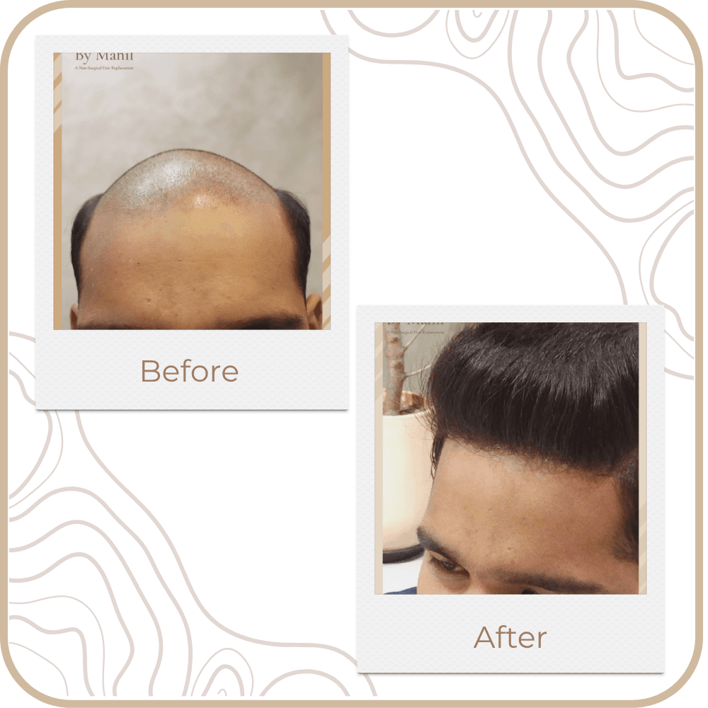 Hair Transformation