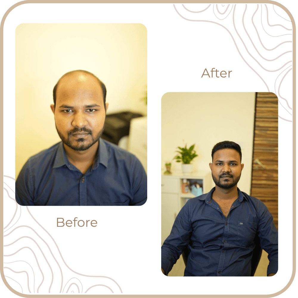 Hair Transformation