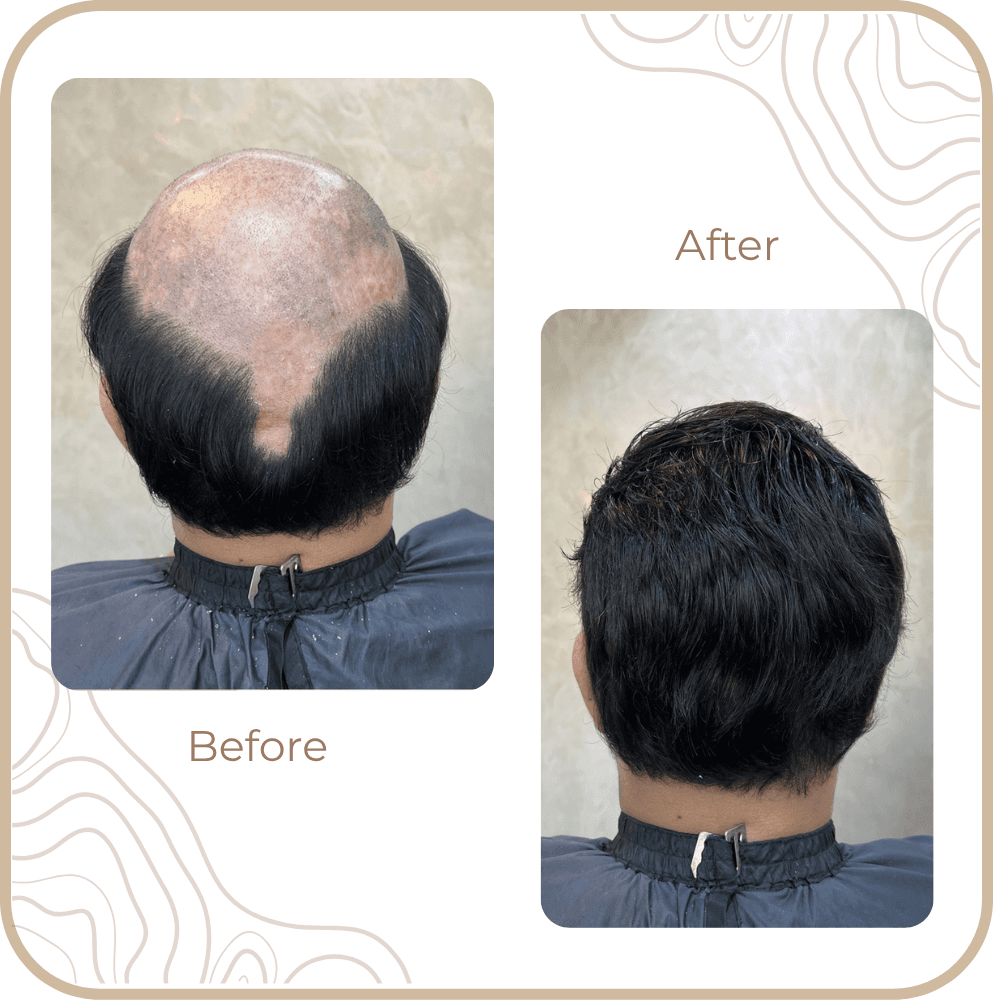 Hair Transformation