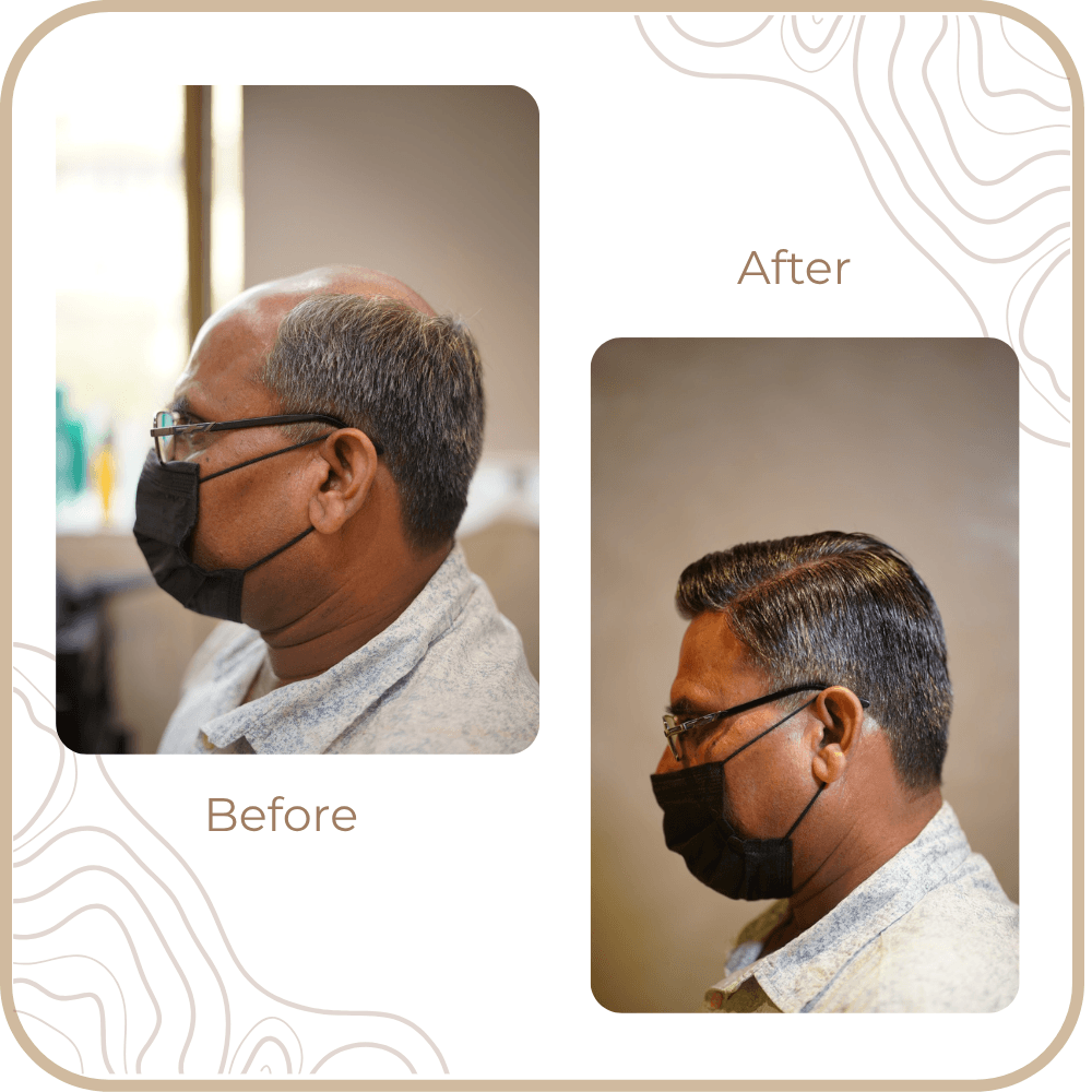 Hair Transformation