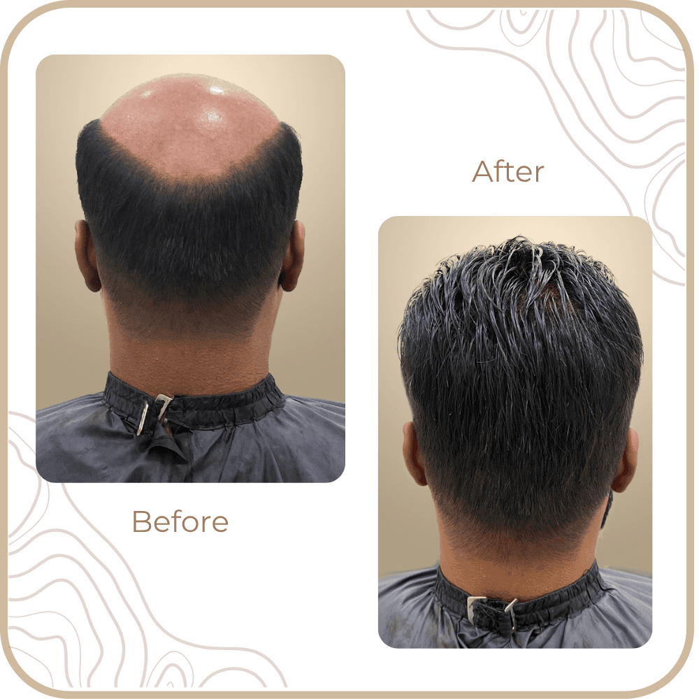 Hair Transformation