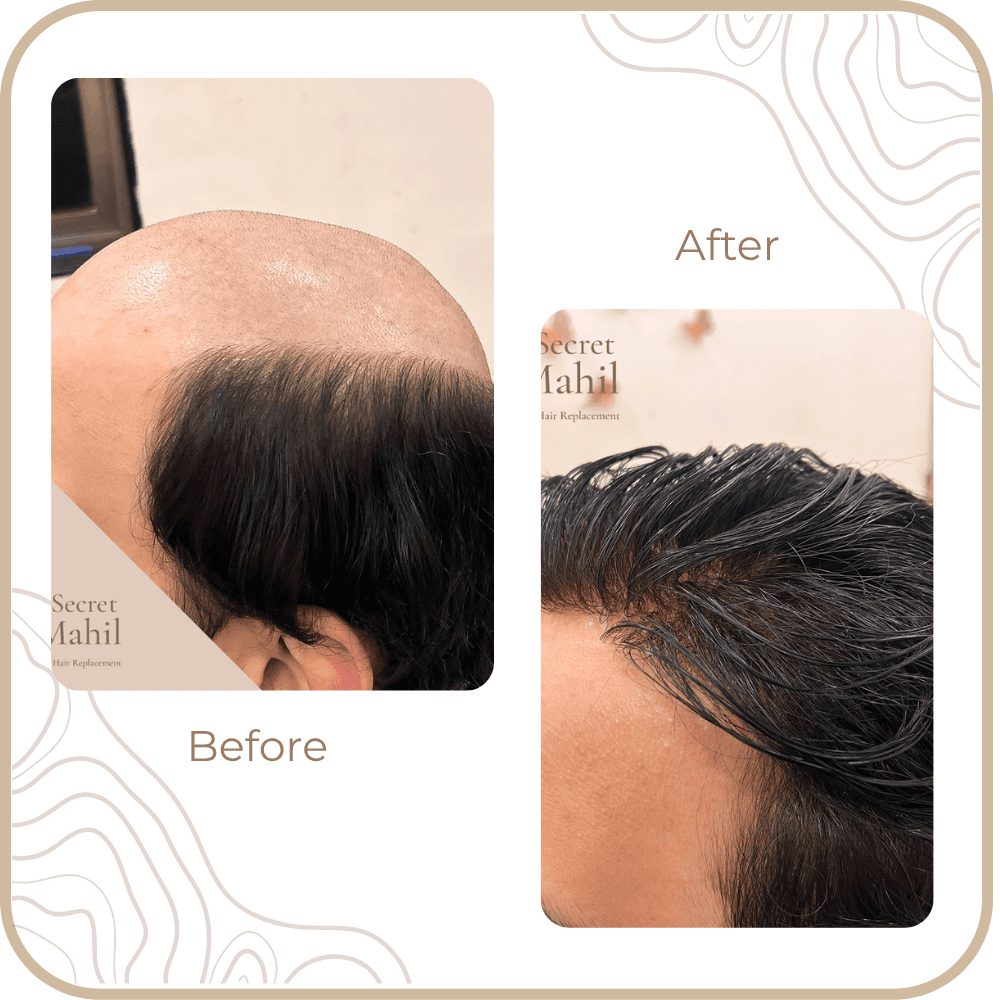 Hair Transformation