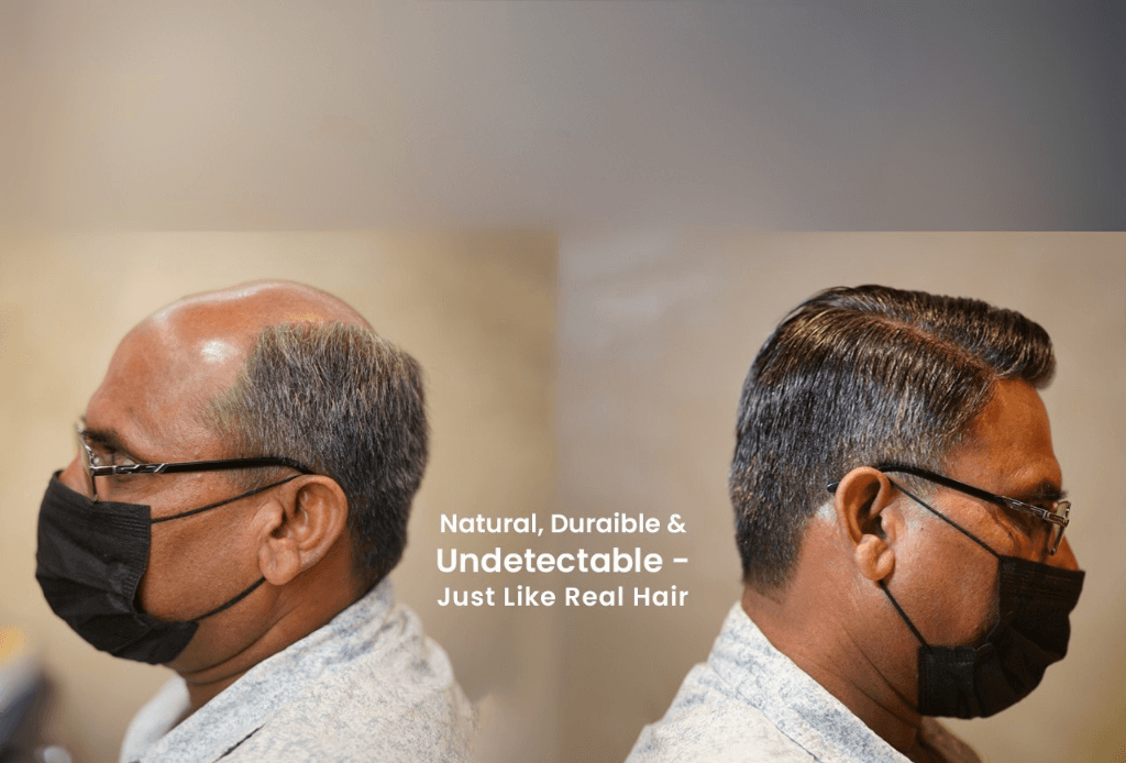New Hair System Cut